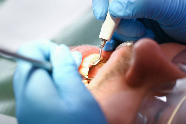 Best Broken Tooth Emergency  in Crystal River, FL