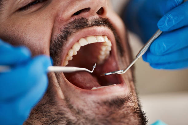 Best Tooth Infection Emergency Dentist  in Crystal River, FL