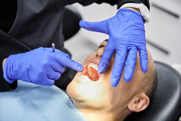 Best Teeth Whitening  in Crystal River, FL